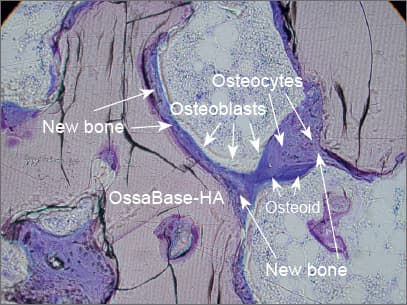 Histologie — detail osteokondukce